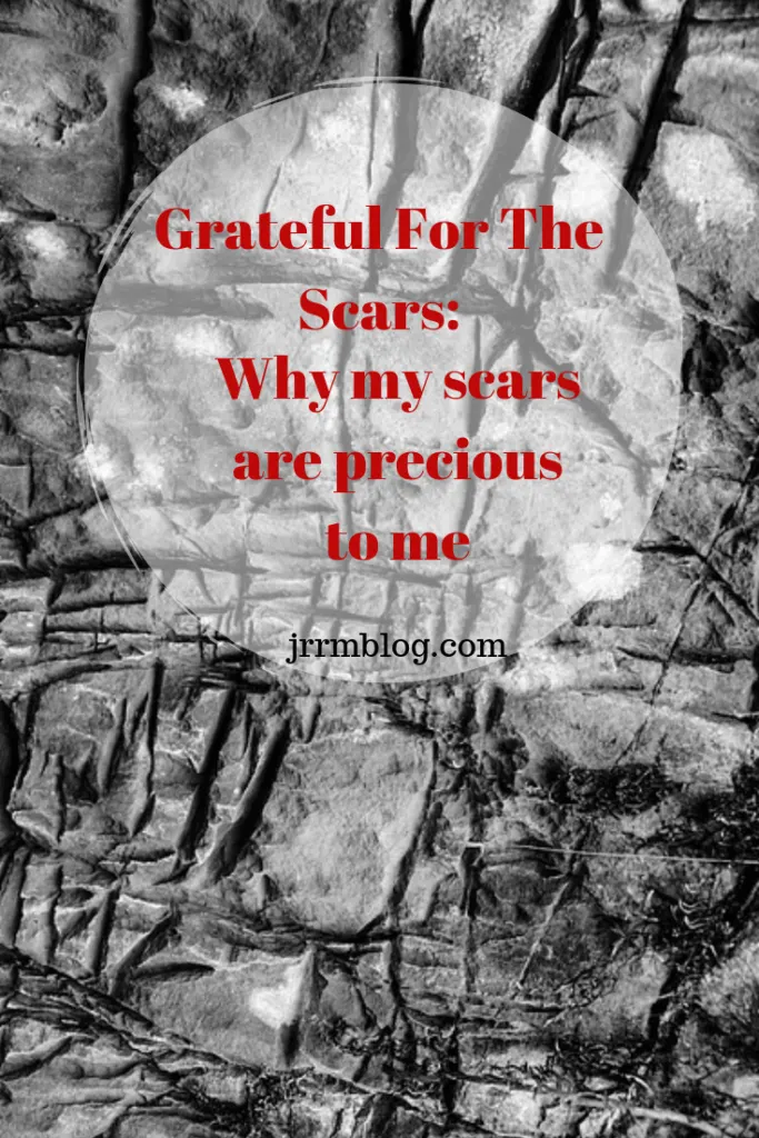 Grateful For The Scars - why I see my scars as precious.